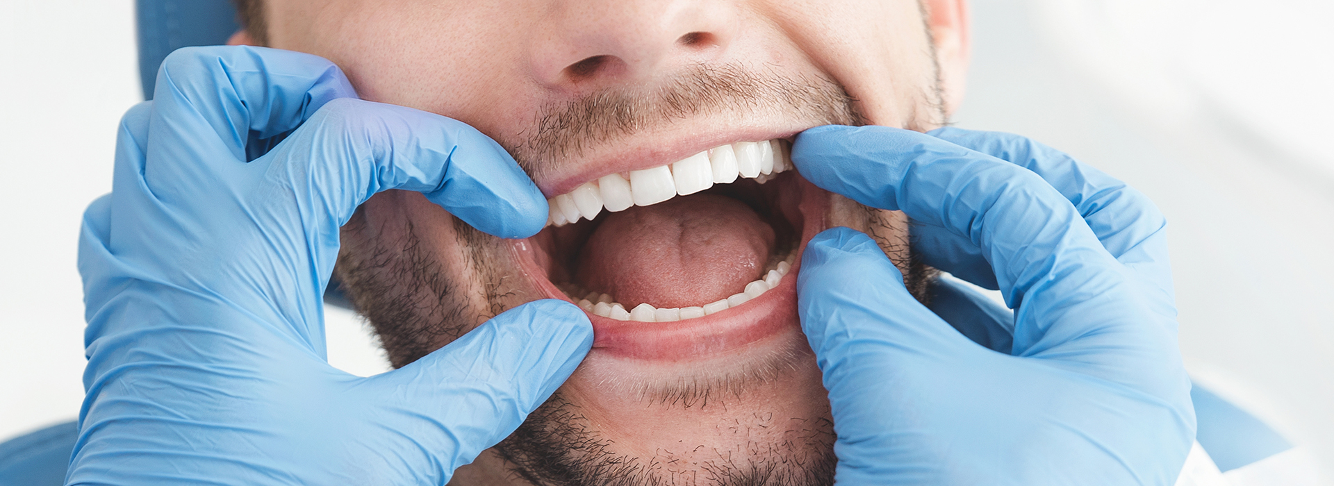 Napa Dental | Periodontal Treatment, Dental Cleanings and Dental Sealants