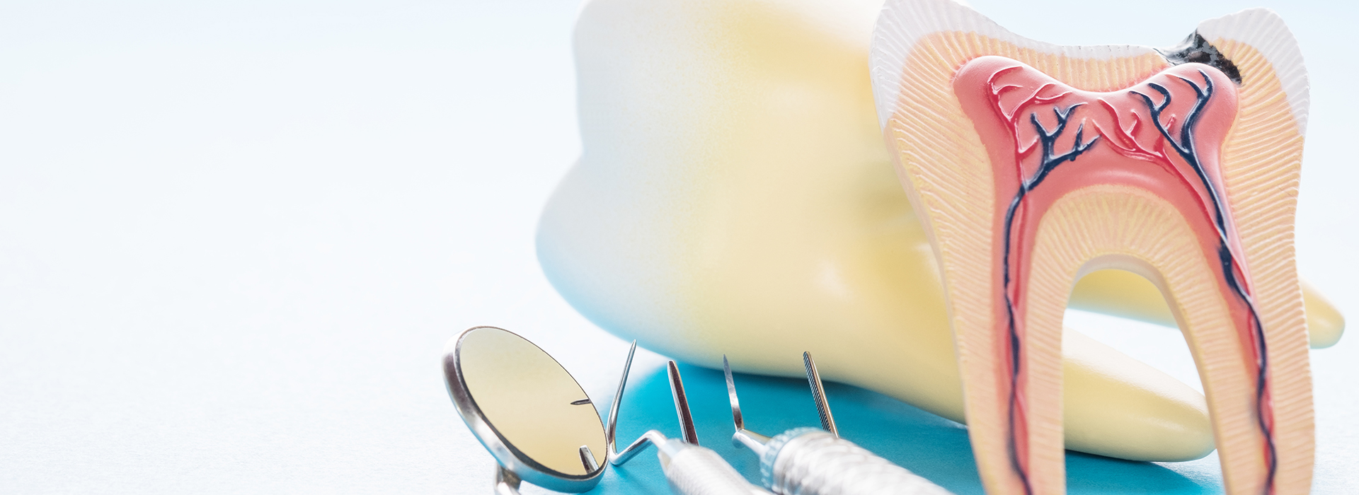 Napa Dental | Dental Fillings, Veneers and Teeth Whitening