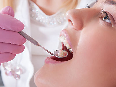 Napa Dental | Orthodontics, Crowns  amp  Caps and Extractions